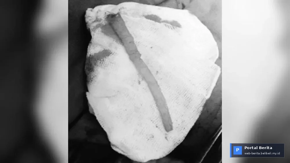 Medical Warning 2026: Never Treat Incontinence with Super Glue – A Tragic Case Serves as Caution!