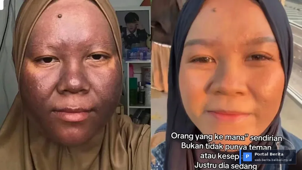 Viral di 2026: Kisah Ayu Lestari, Wanita yang Sukses Pulihkan Kulitnya dari Kerusakan Krim Merkuri