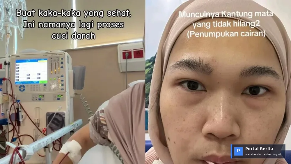 Kisah Viral Wanita Bekasi: Waspadai Gejala Gagal Ginjal yang Sering Diabaikan!